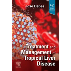Image of Treatment and Management of Tropical Liver Disease, 1st edition